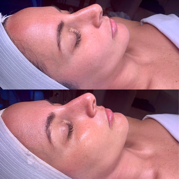 Before and after comparison of a woman's face with close-up details.