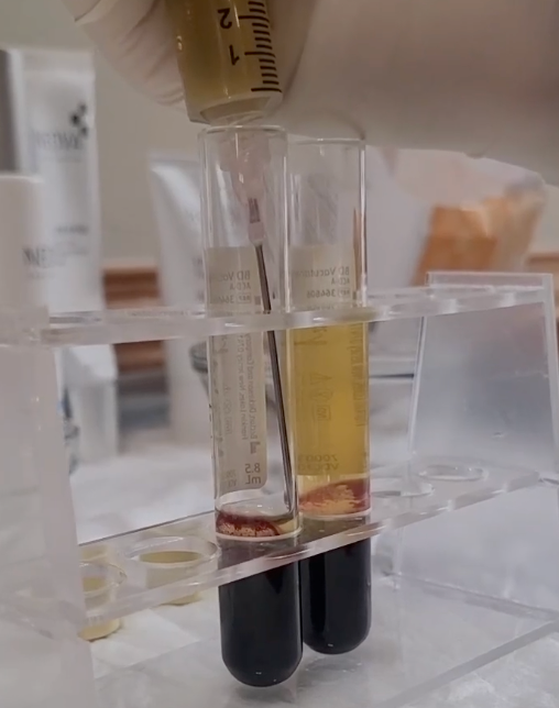Laboratory setting with test tubes and a pipette, likely for scientific research or analysis.