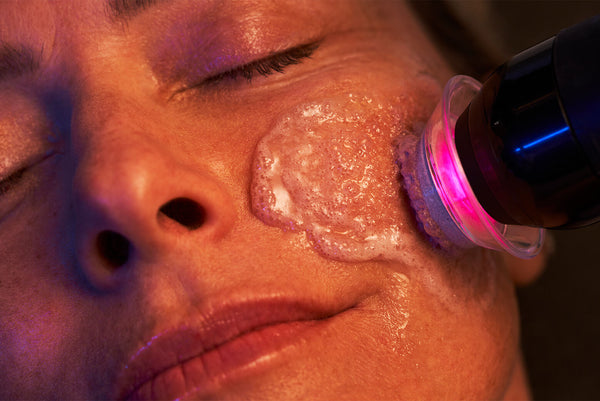 Glo2 Facial Platinum