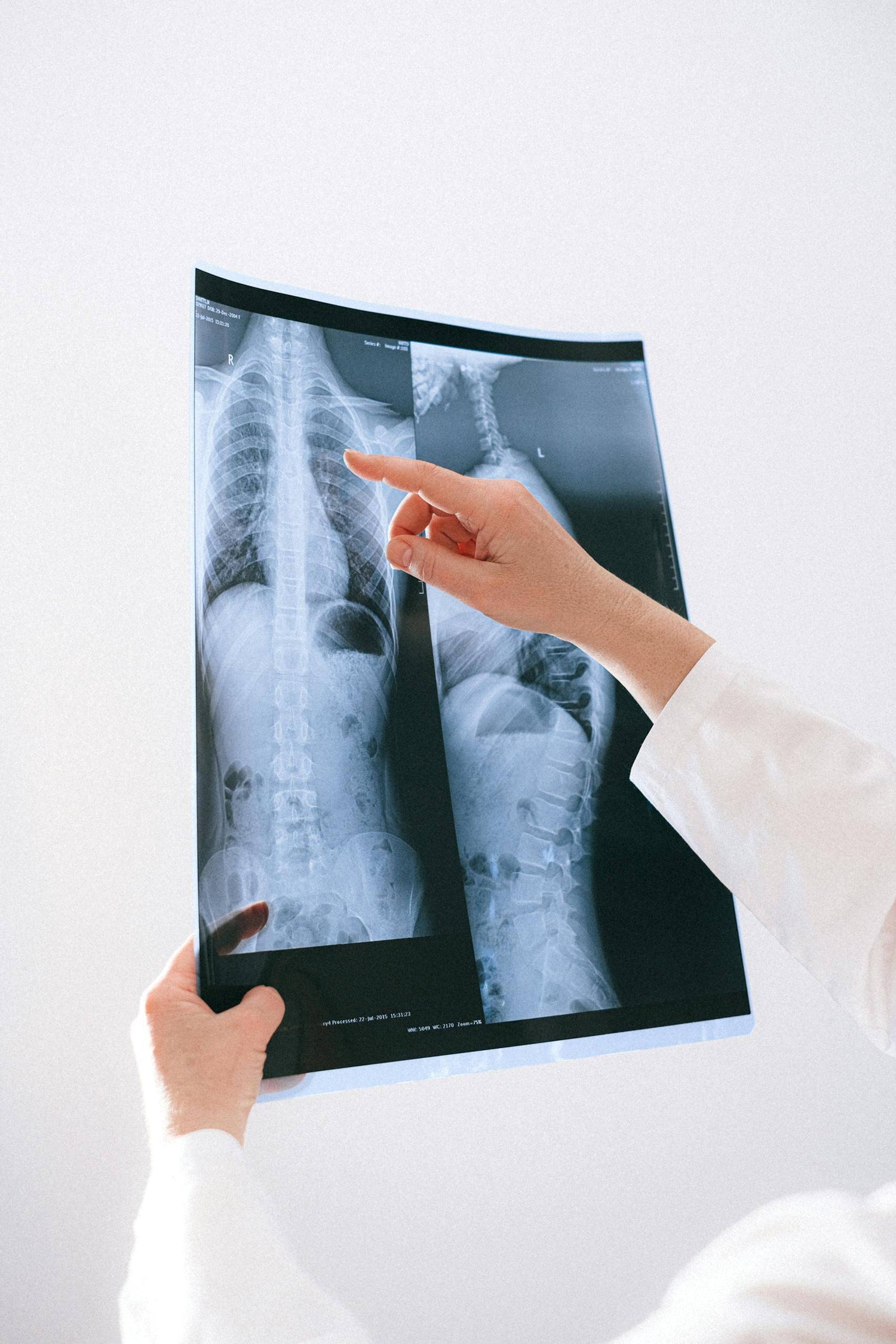 spine and joint x-ray