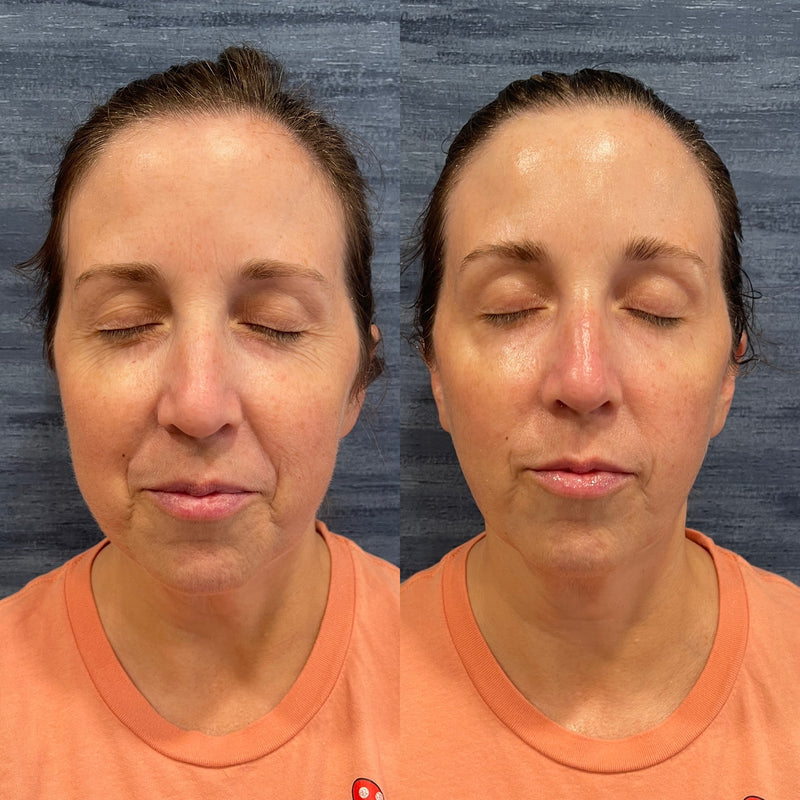 Patient result