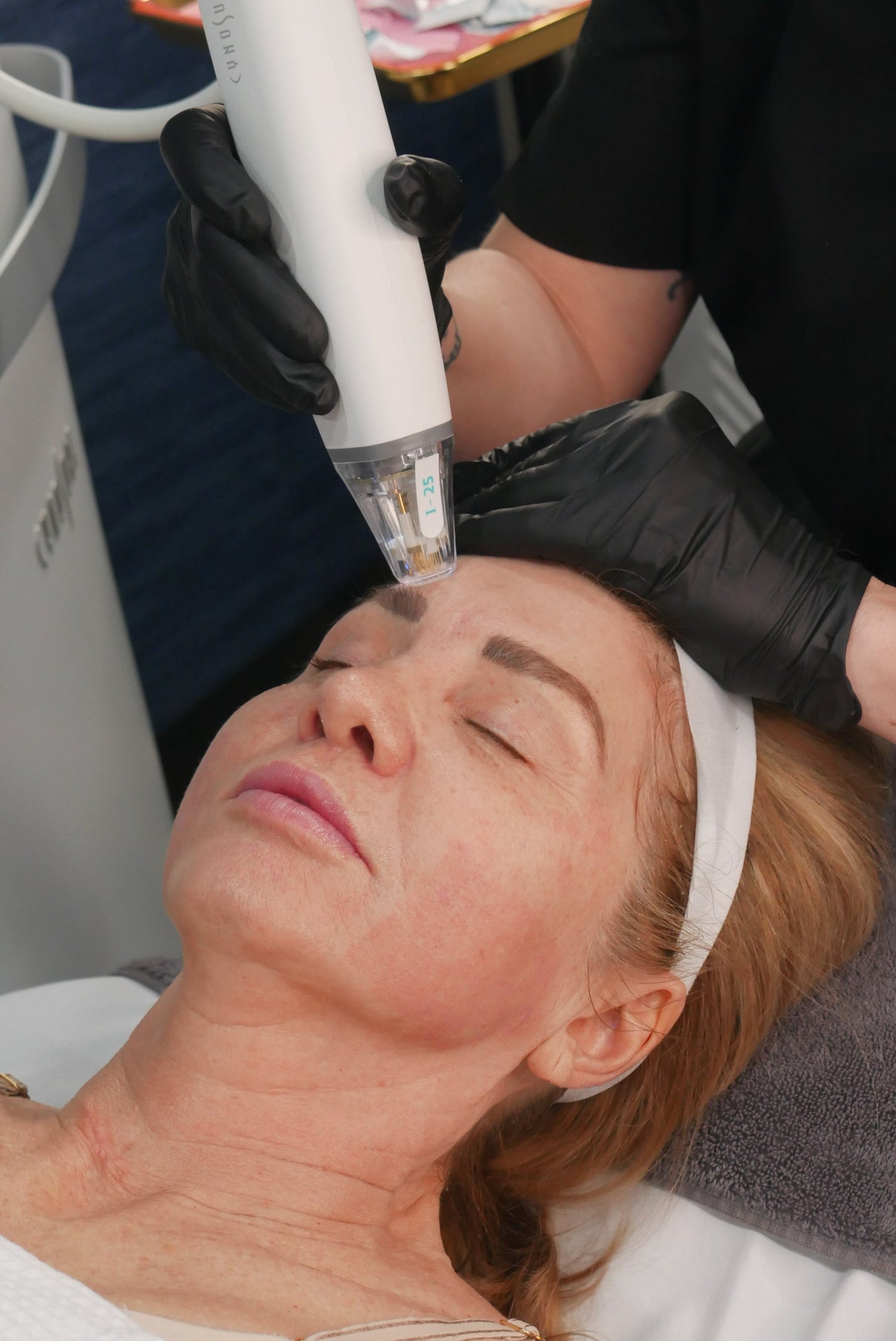 model getting microneedling
