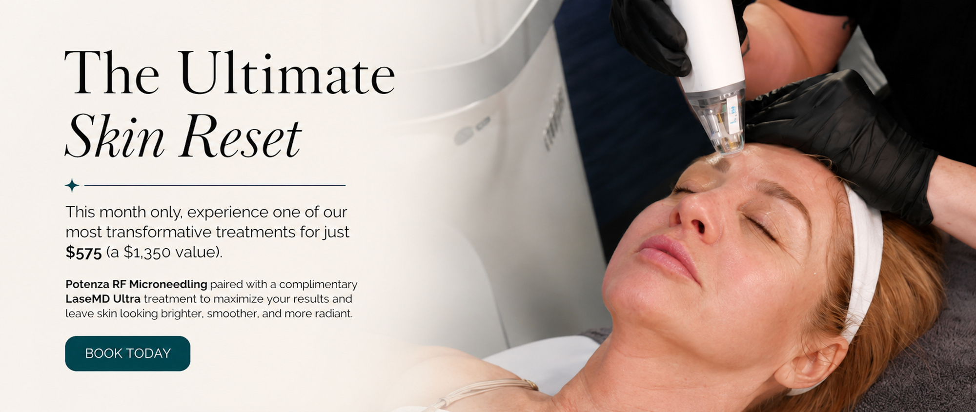 model getting microneedling banner