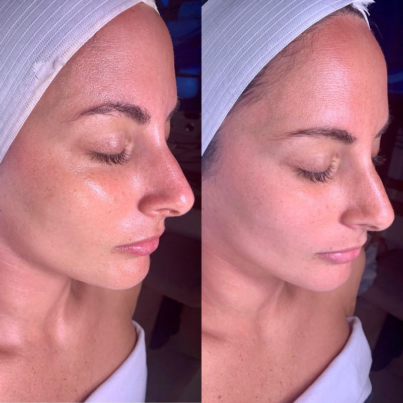 Patient result